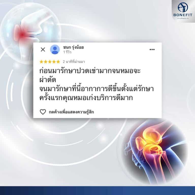 knee-center_review80